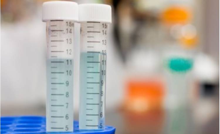 روش های اندازه گیری TOC